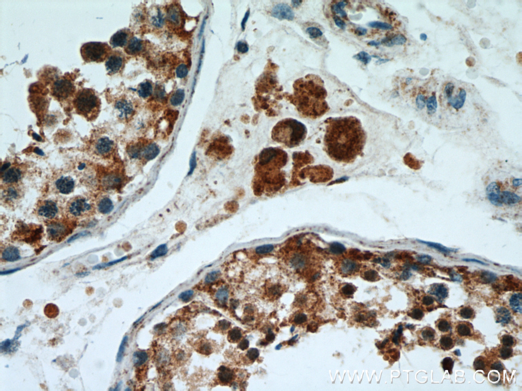 IHC staining of human testis using 14022-1-AP