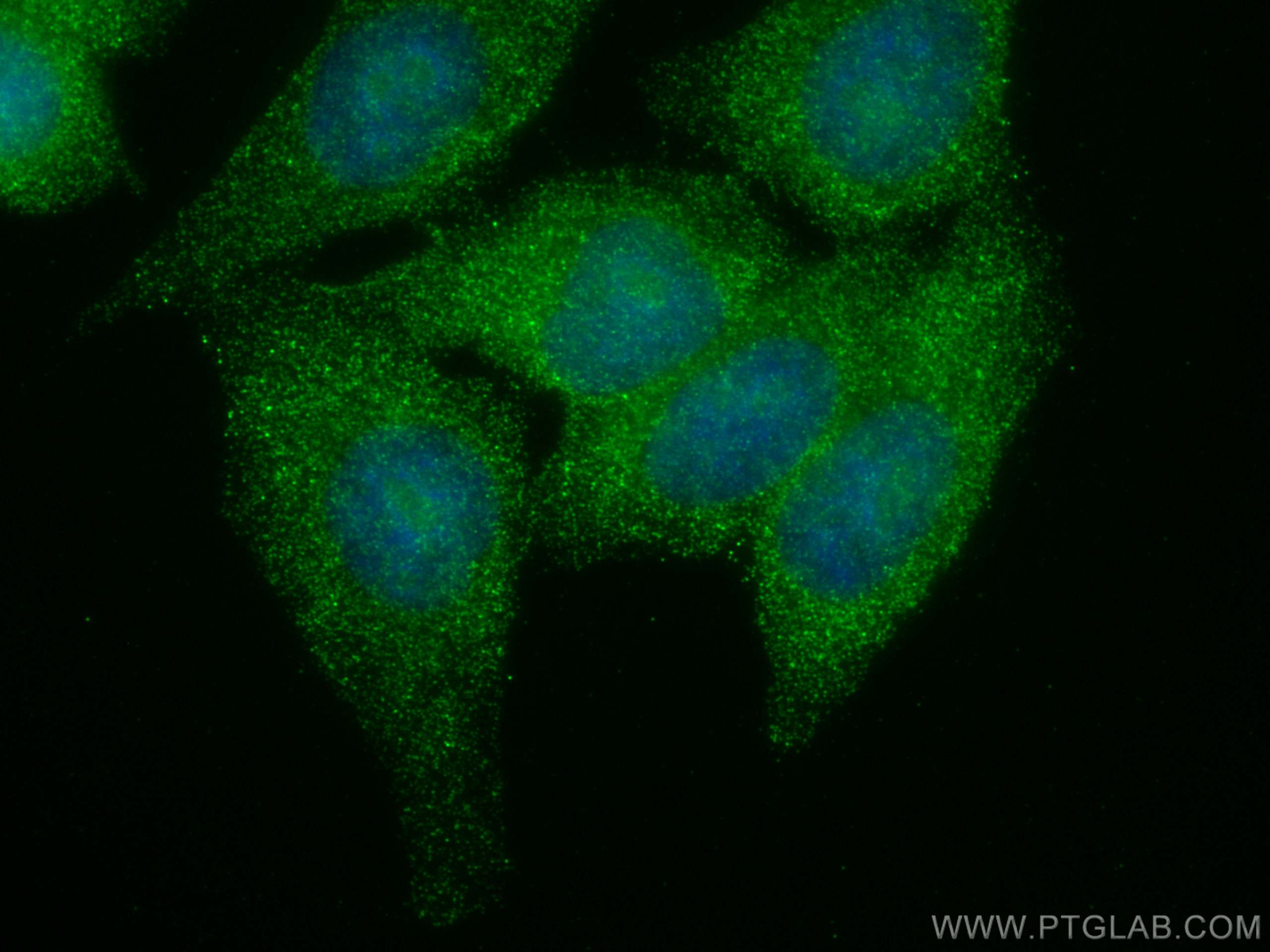 IF Staining of HepG2 using 68123-1-Ig (same clone as 68123-1-PBS)