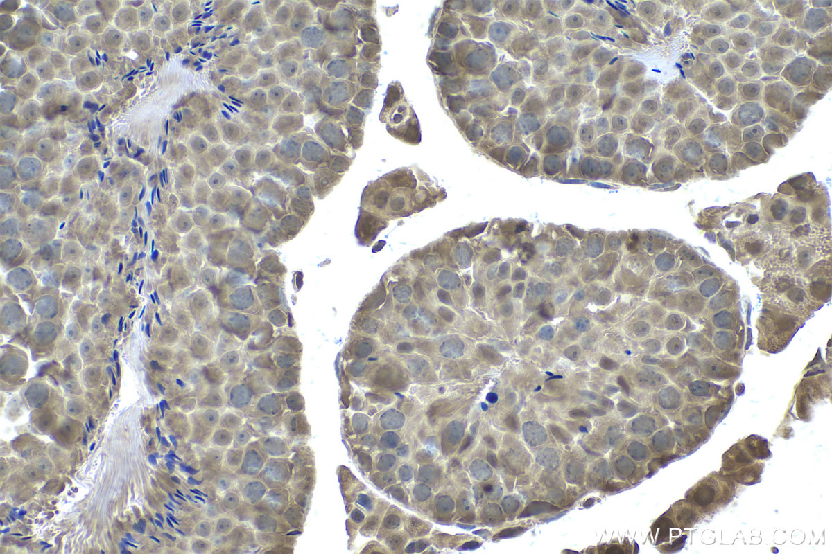 IHC staining of mouse testis using 68123-1-Ig (same clone as 68123-1-PBS)