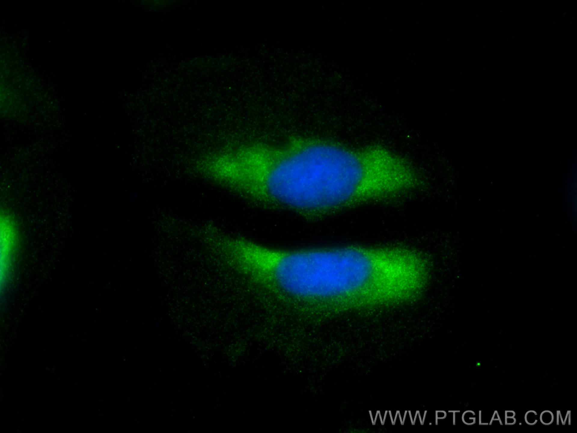 IF Staining of U2OS using 11749-1-AP