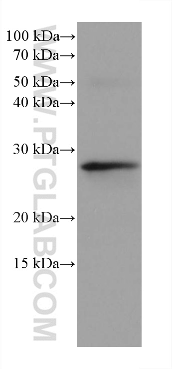 WB analysis of rat thymus using 66403-1-Ig (same clone as 66403-1-PBS)