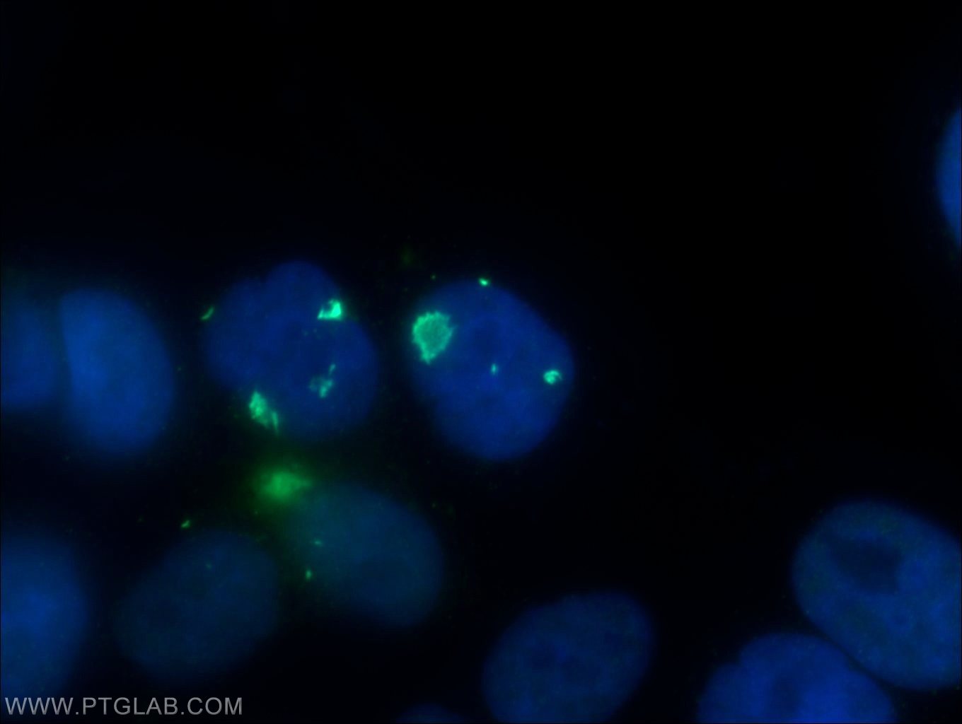 IF Staining of HepG2 using 15154-1-AP