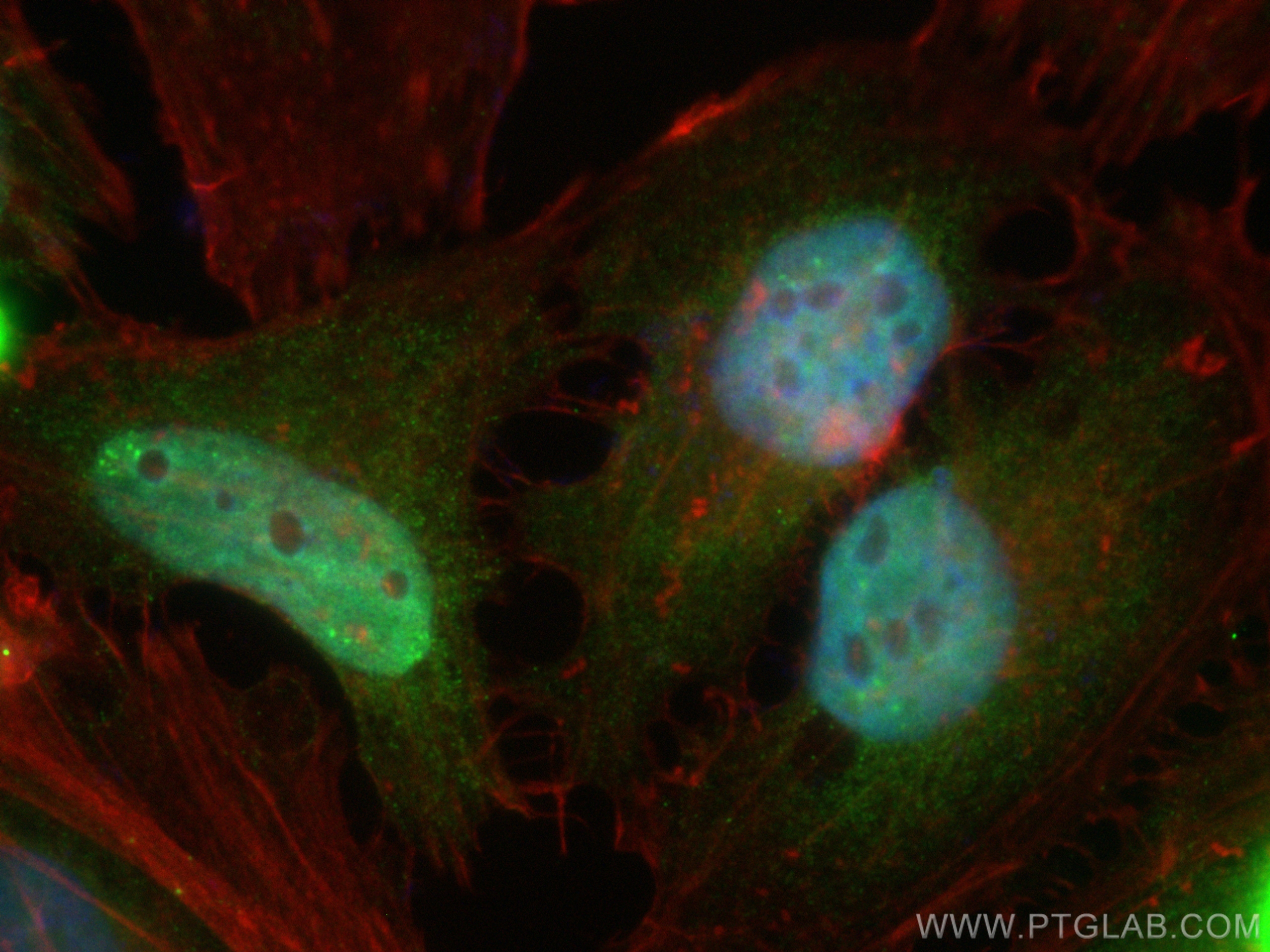 IF Staining of HeLa using CL488-67959