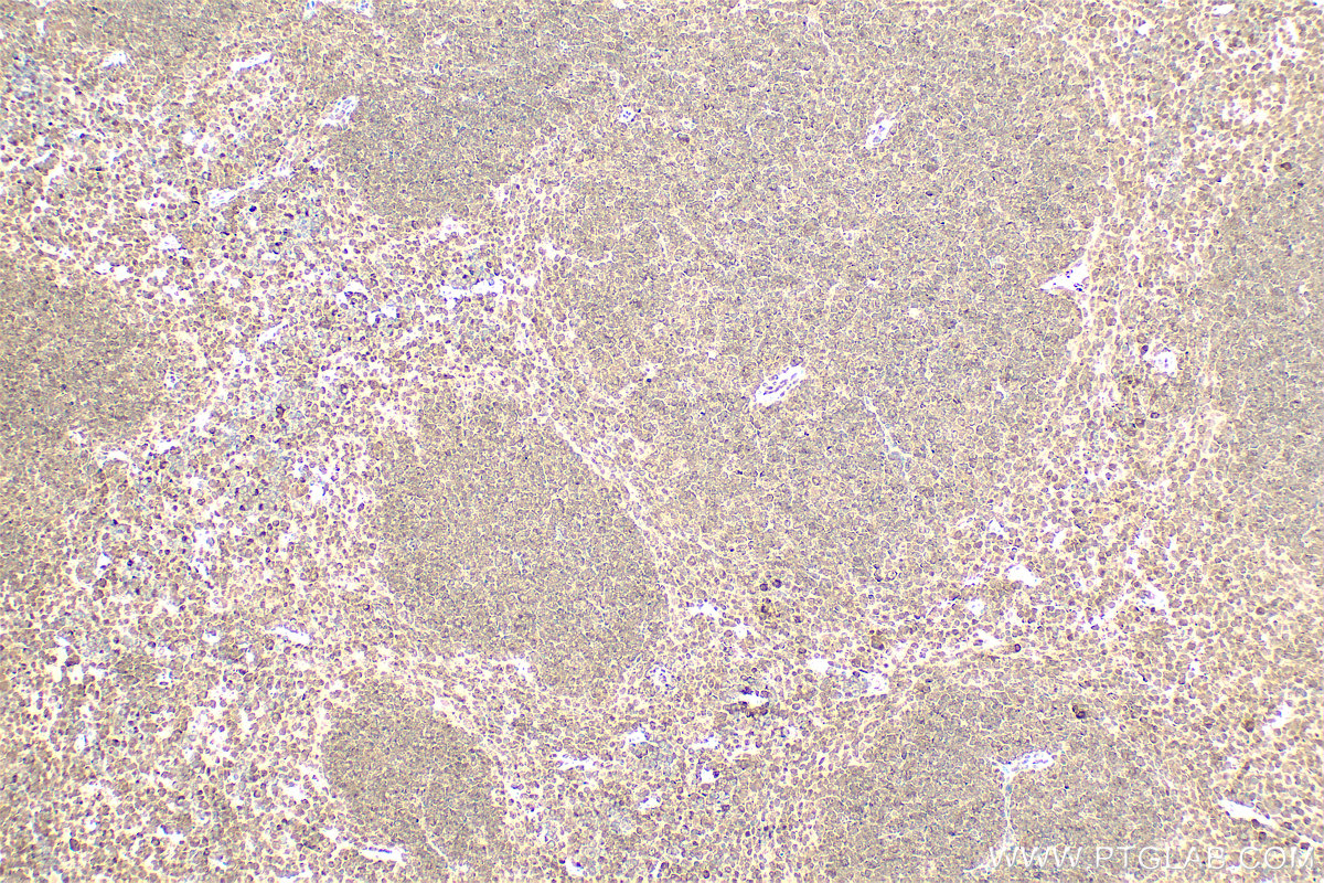 IHC staining of mouse spleen using 14859-1-AP