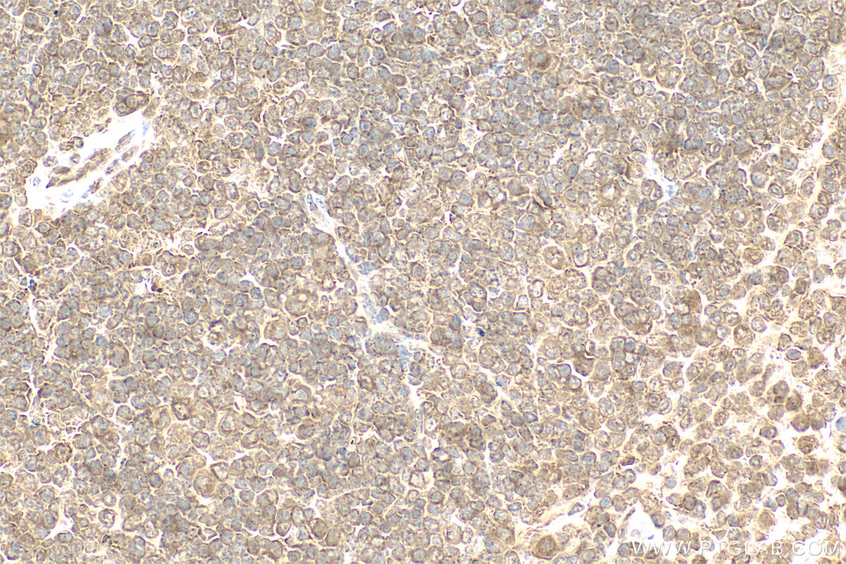 IHC staining of mouse spleen using 14859-1-AP