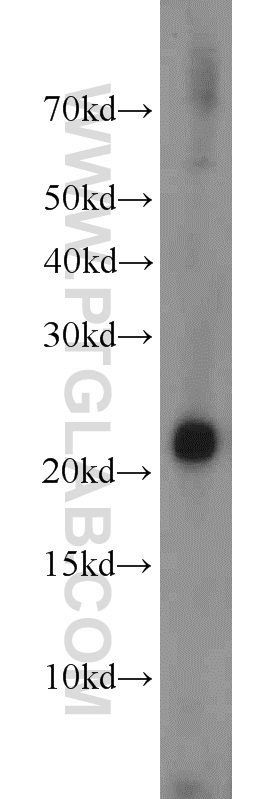 WB analysis of mouse kidney using 14859-1-AP