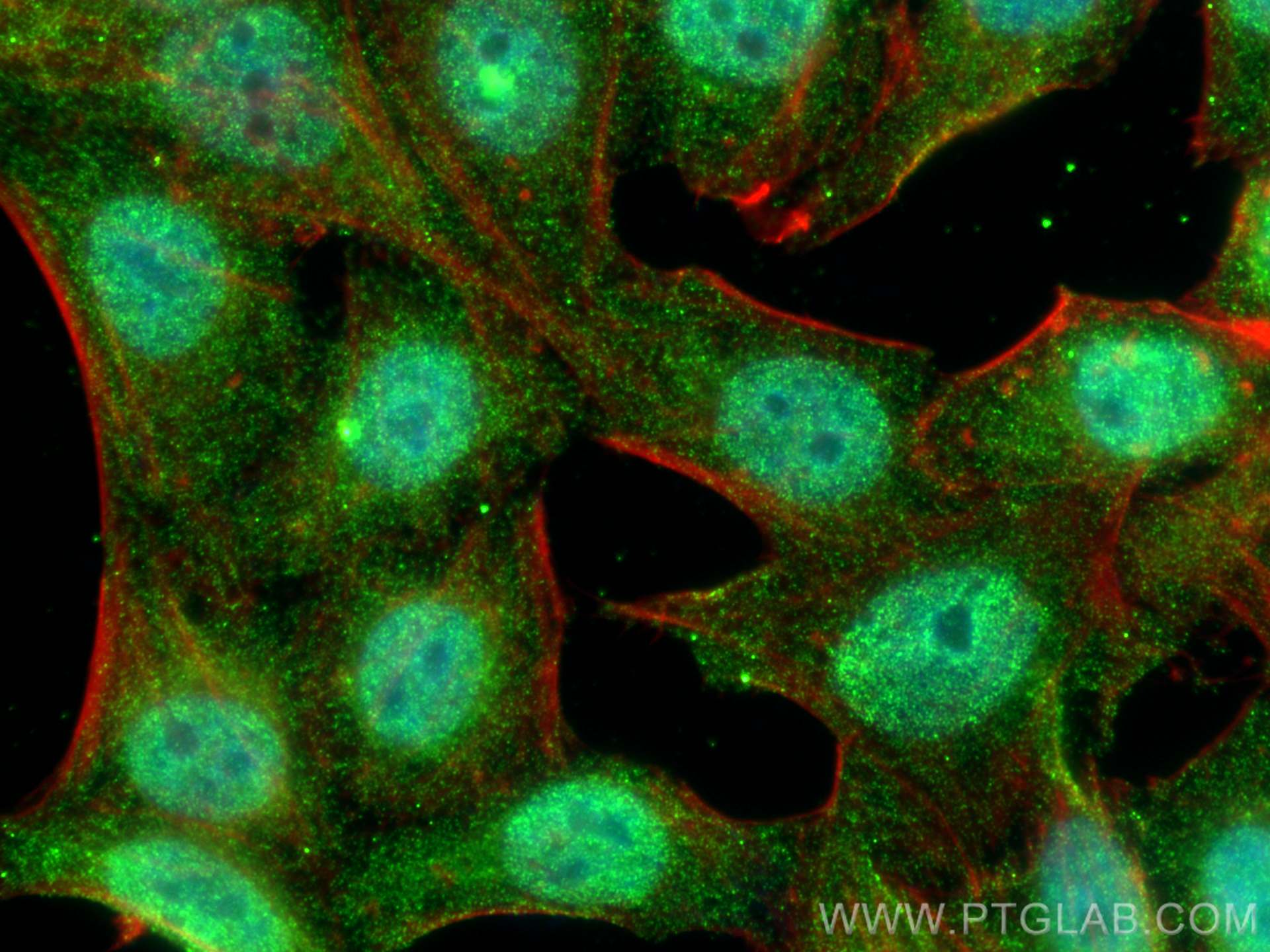 IF Staining of HepG2 using 66759-1-Ig