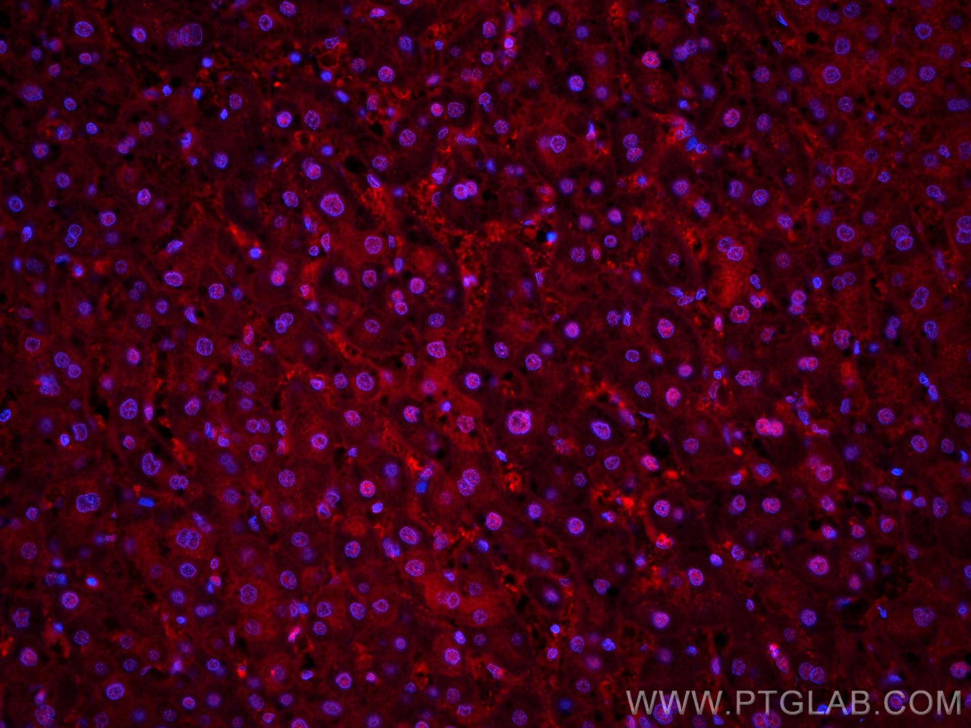 IF Staining of human liver cancer using CL594-66759