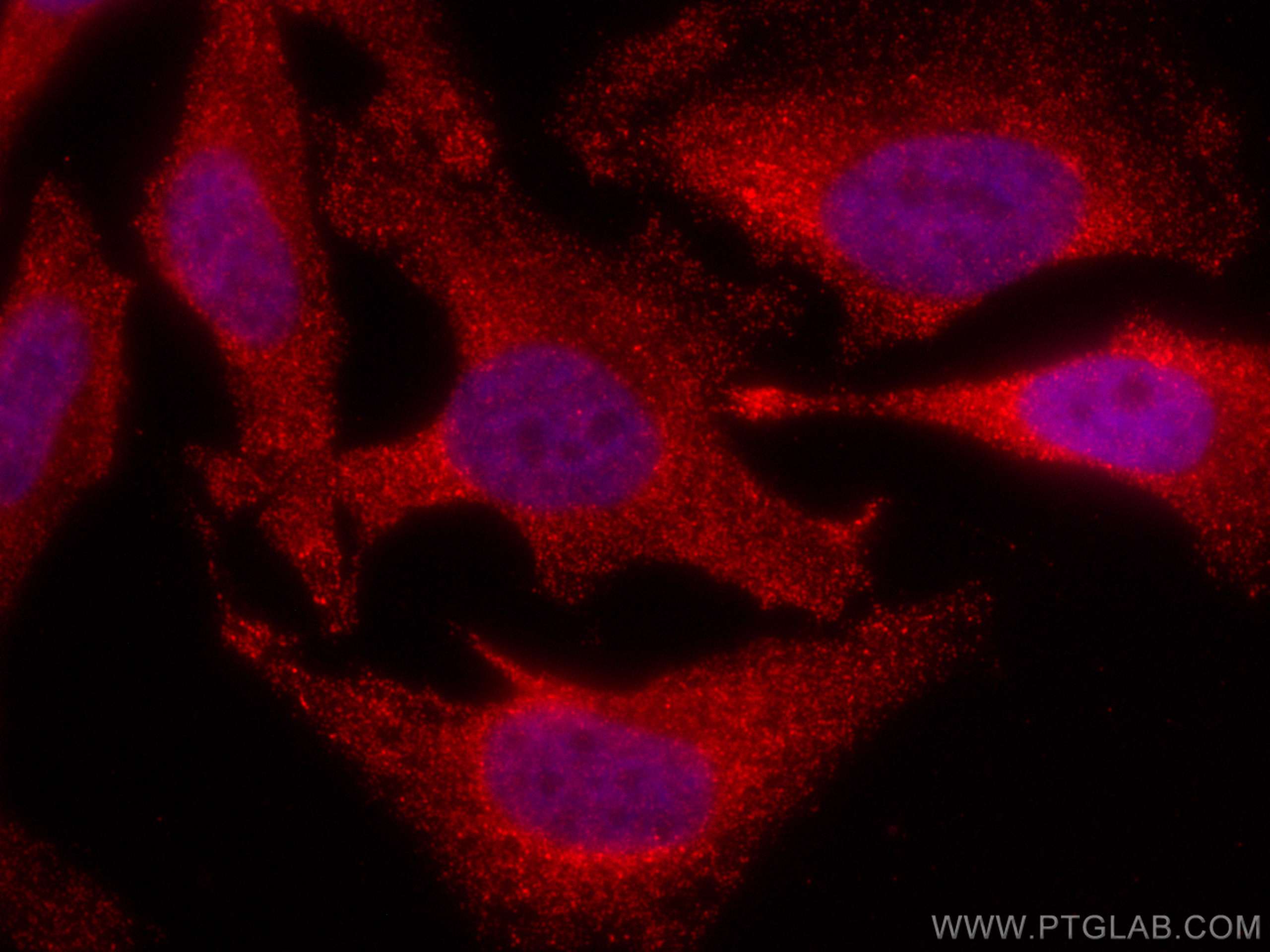 IF Staining of HeLa using CL594-66759