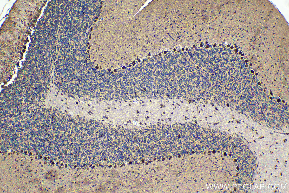 IHC staining of mouse cerebellum using 11196-1-AP