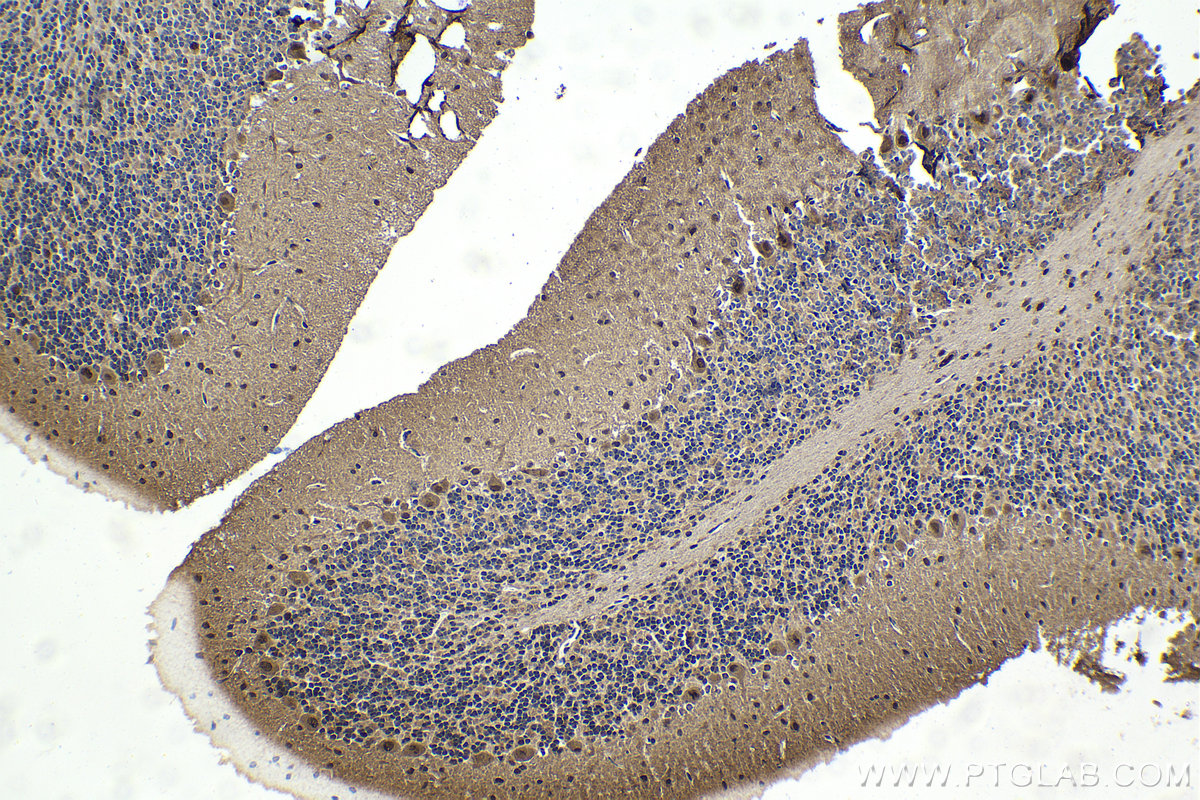 IHC staining of rat cerebellum using 11196-1-AP