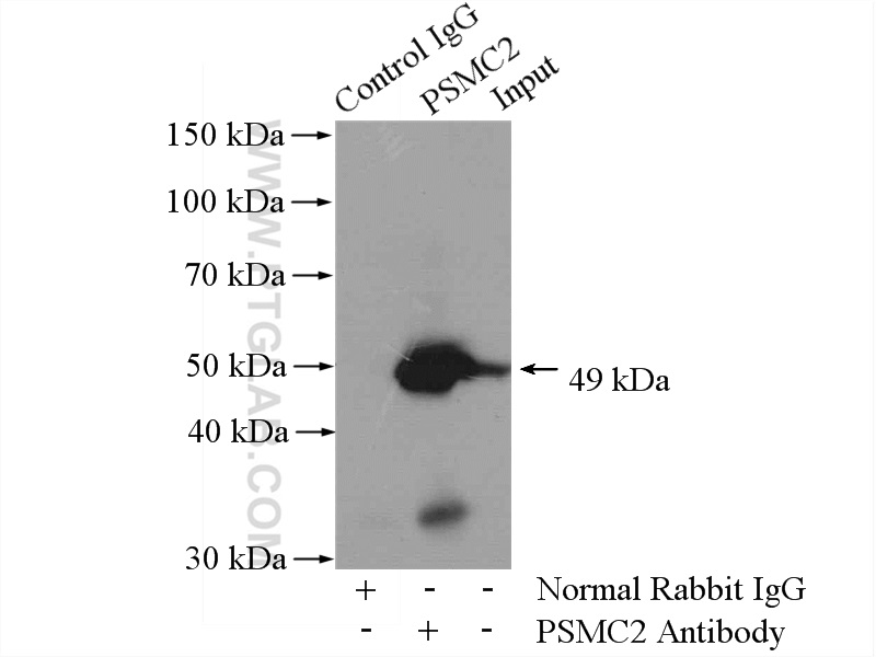 IP experiment of mouse spleen using 14905-1-AP