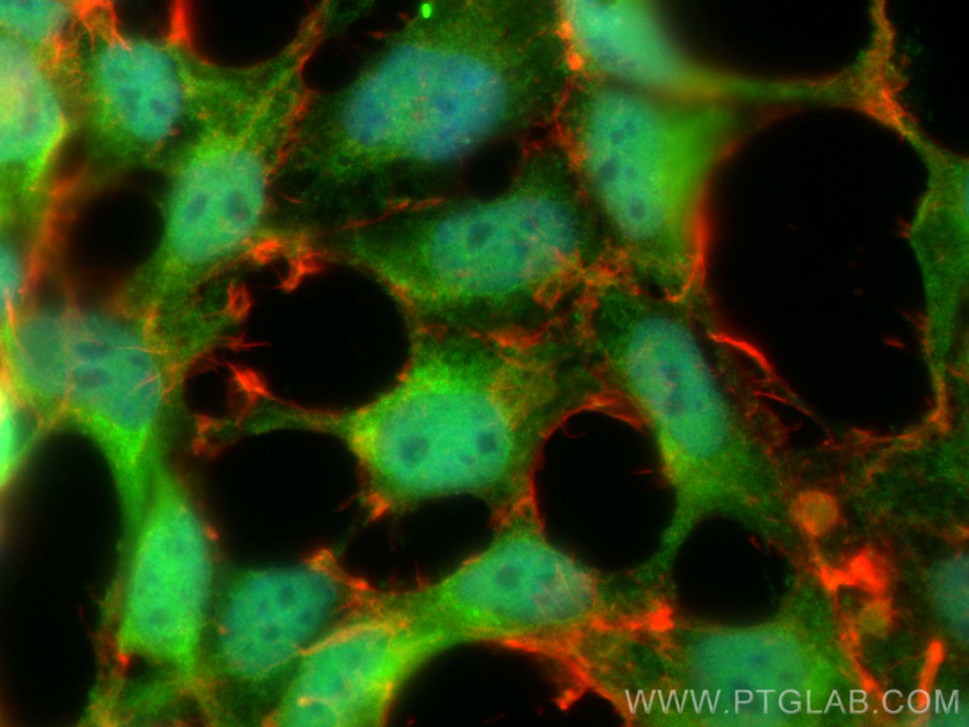 IF Staining of HEK-293 using 24142-1-AP