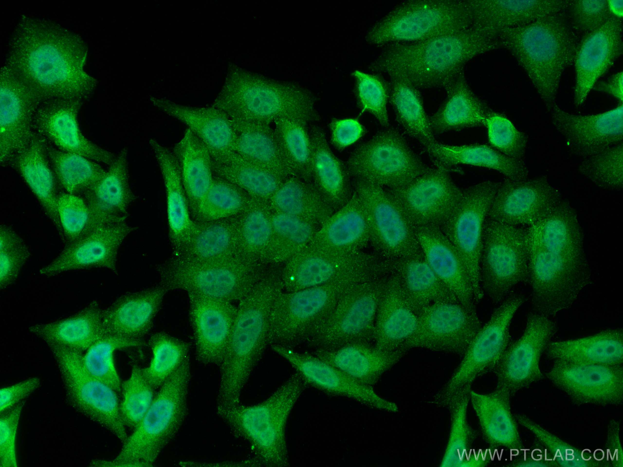 IF Staining of HepG2 using 11339-1-AP