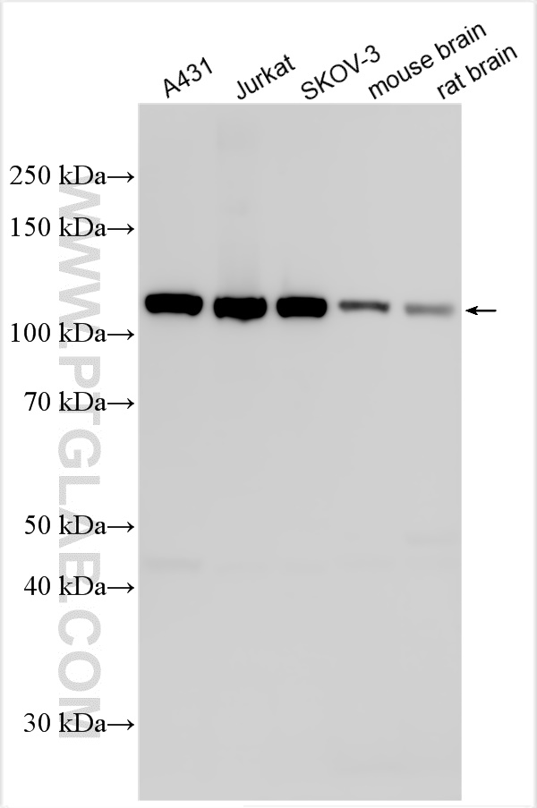 WB analysis using 31912-1-AP