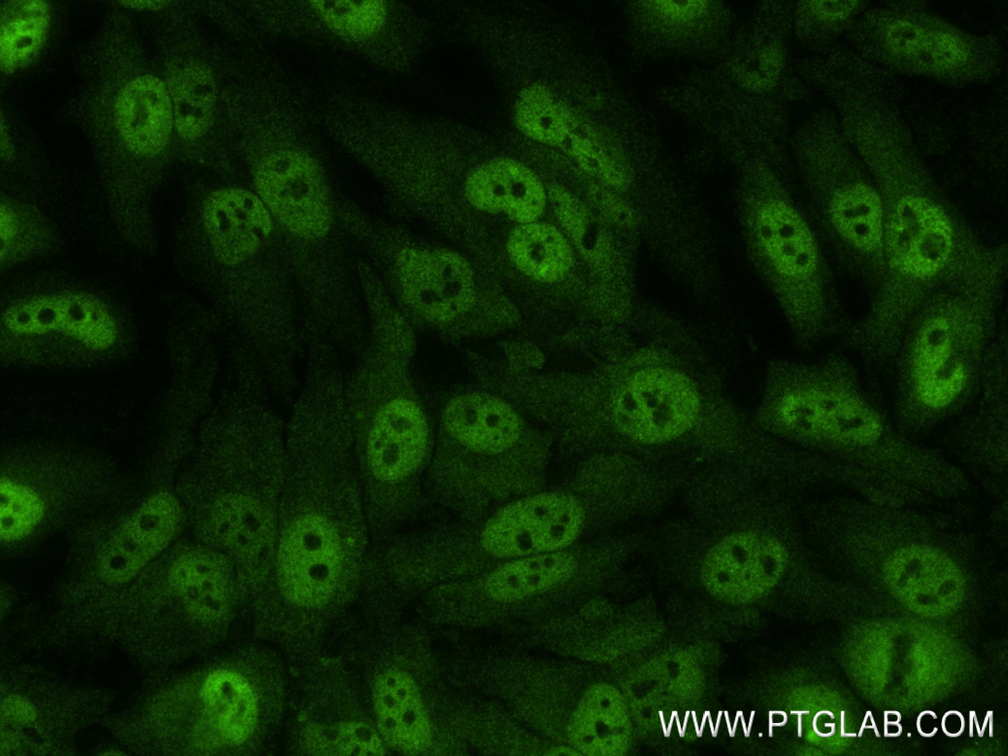 IF Staining of HeLa using 83521-4-RR (same clone as 83521-4-PBS)