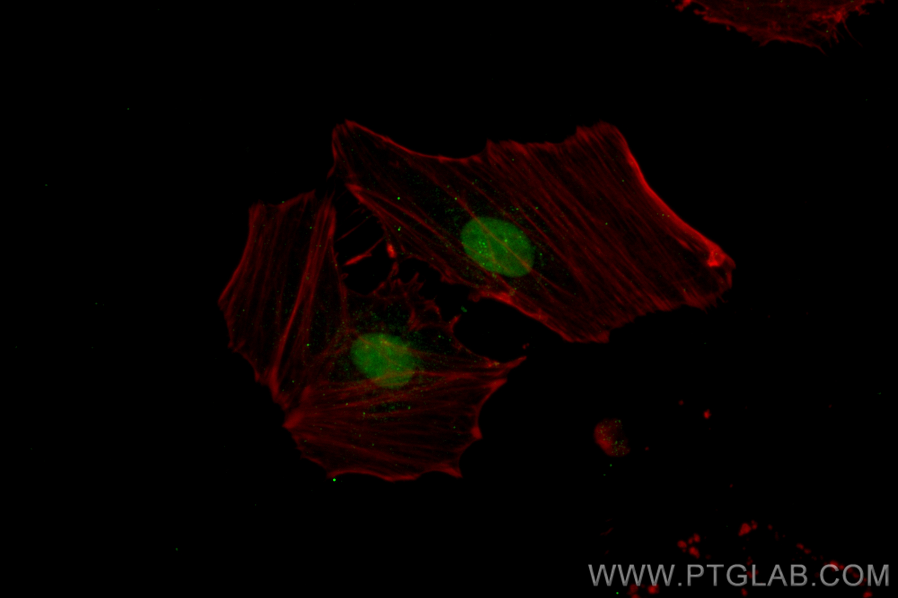 IF Staining of HeLa using CL488-83521-4