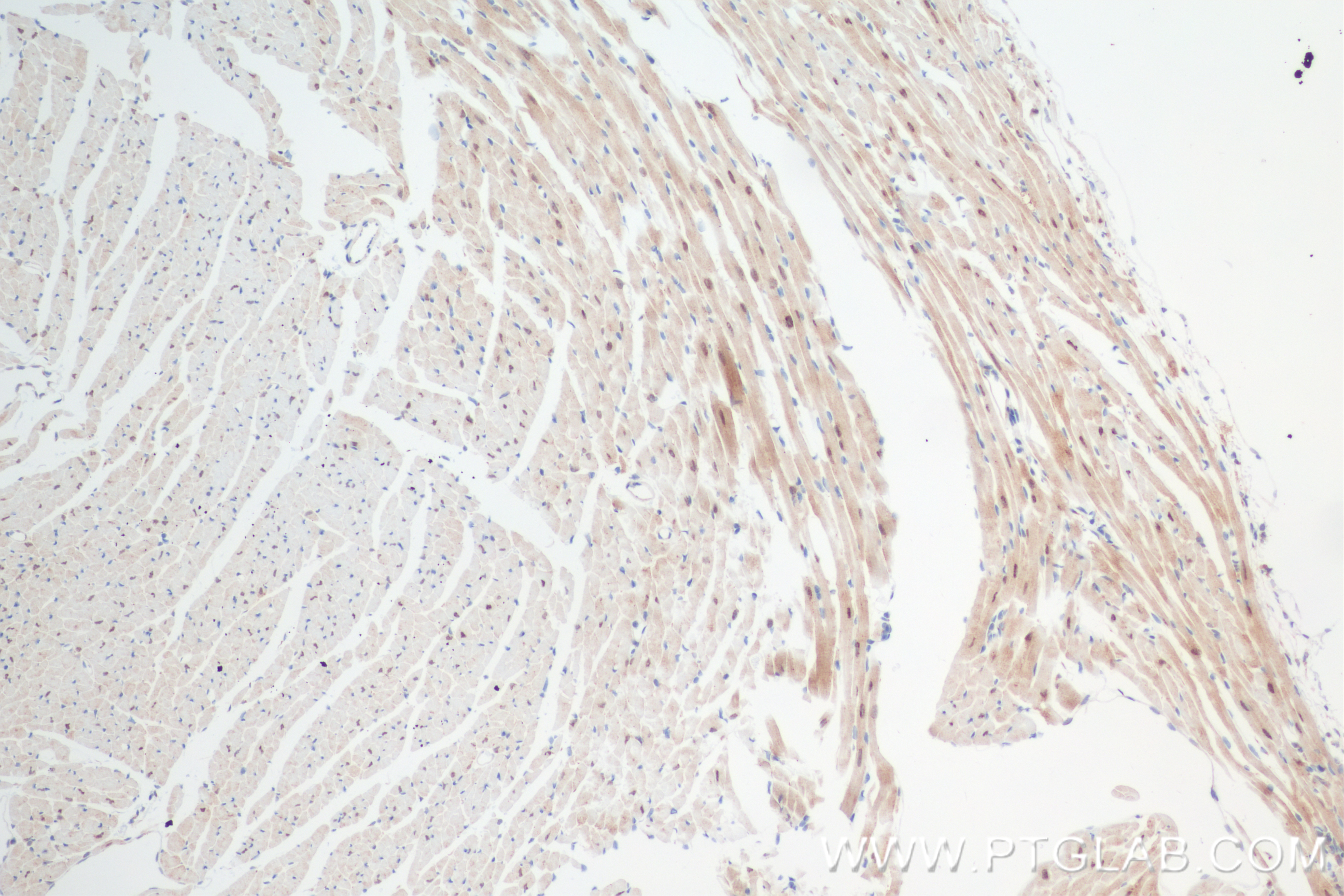 IHC staining of mouse heart using 84767-3-RR (same clone as 84767-3-PBS)