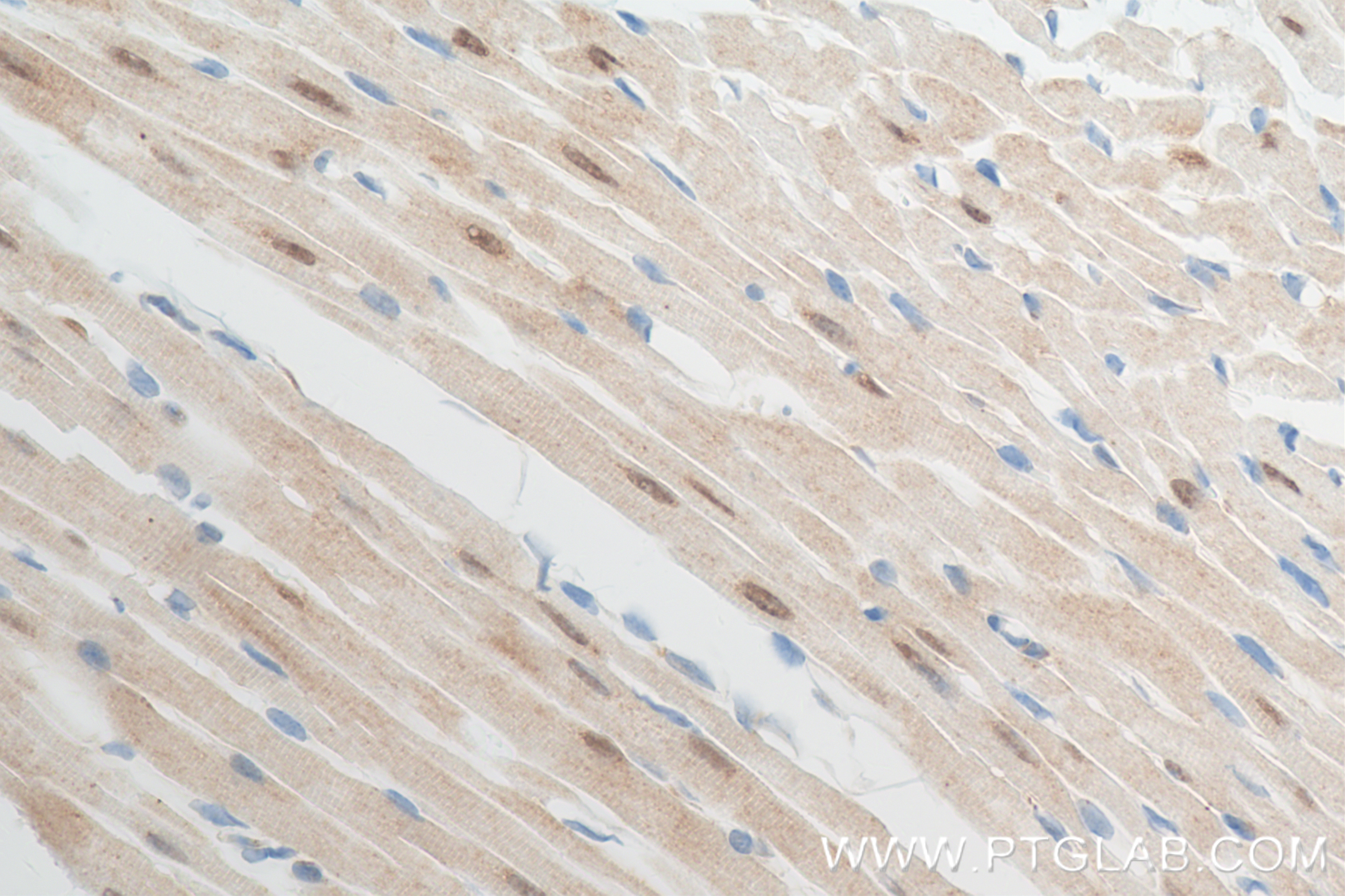 IHC staining of mouse heart using 84767-3-RR (same clone as 84767-3-PBS)