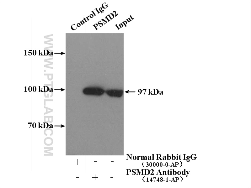 IP experiment of K-562 using 14748-1-AP