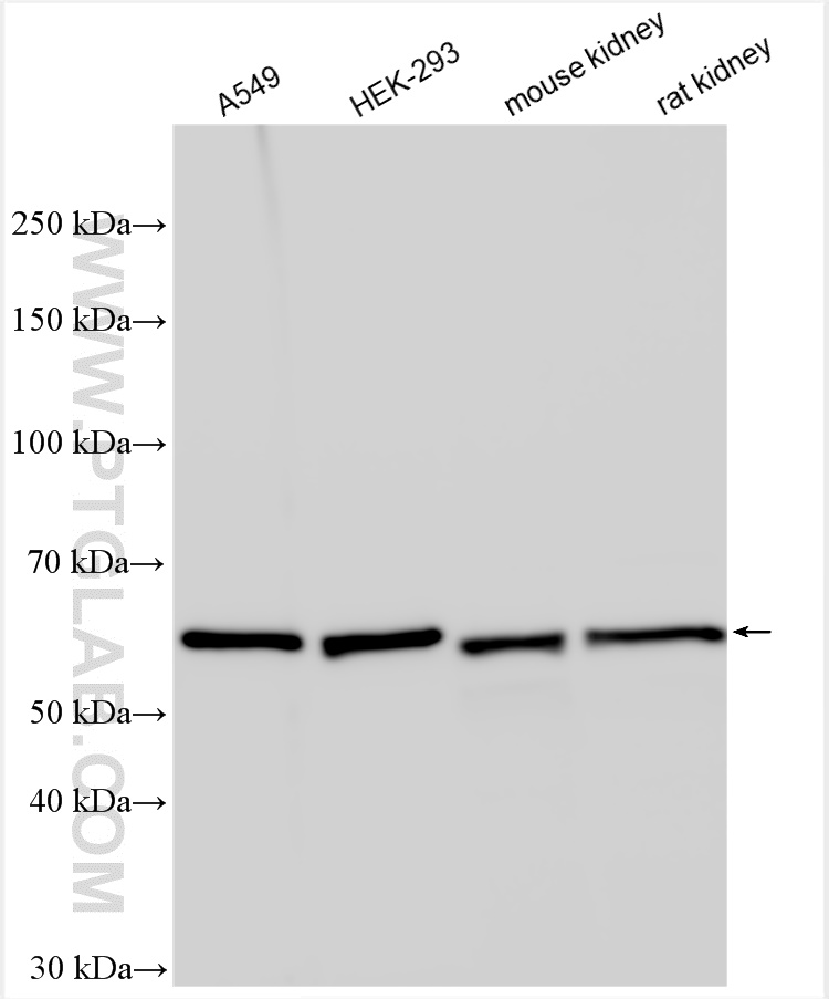 WB analysis using 12054-1-AP