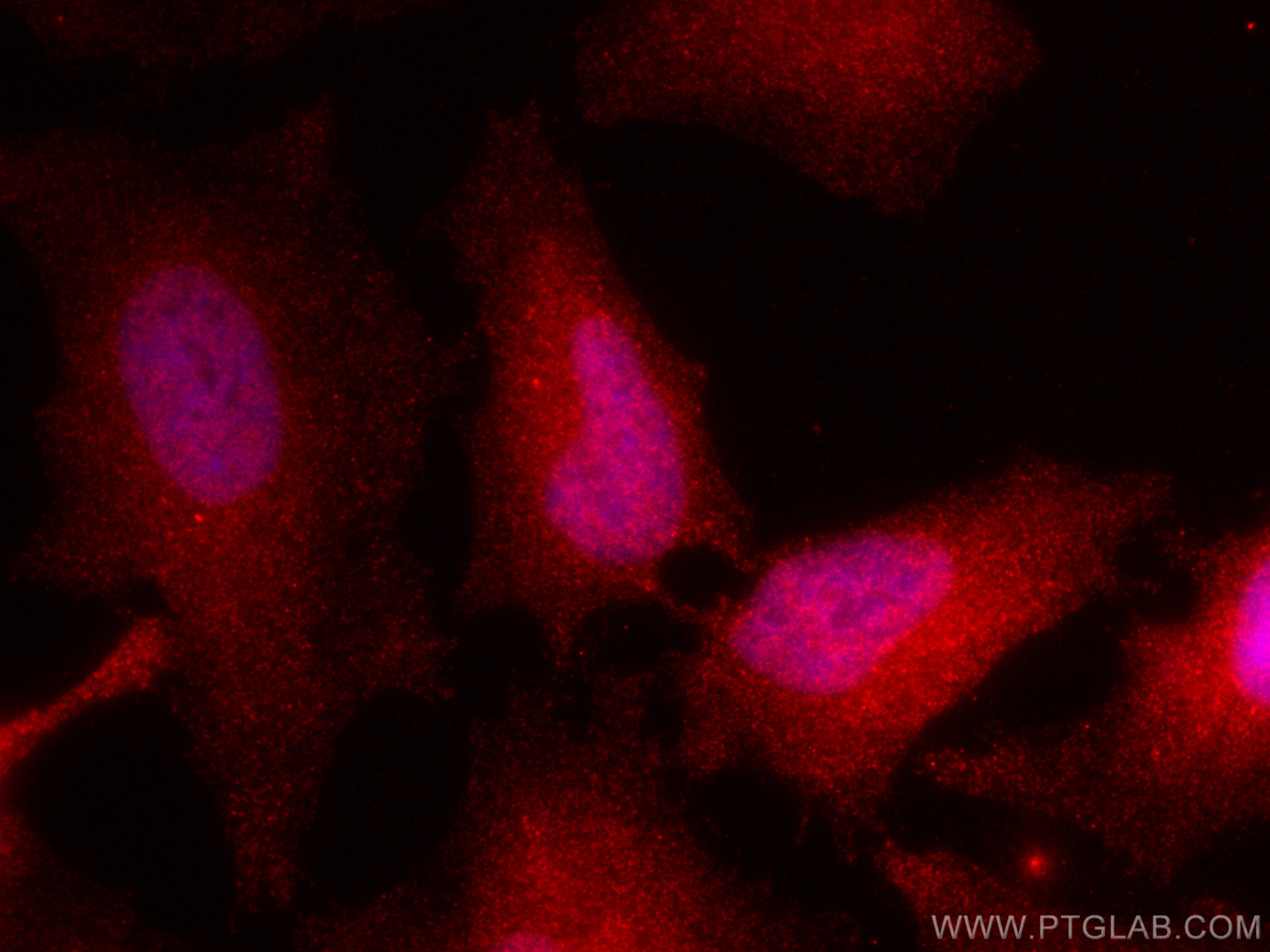 IF Staining of HeLa using CL594-66179