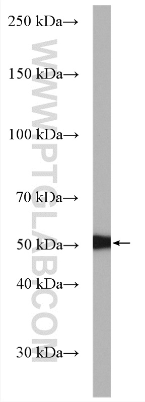 WB analysis of HeLa using 11469-1-AP