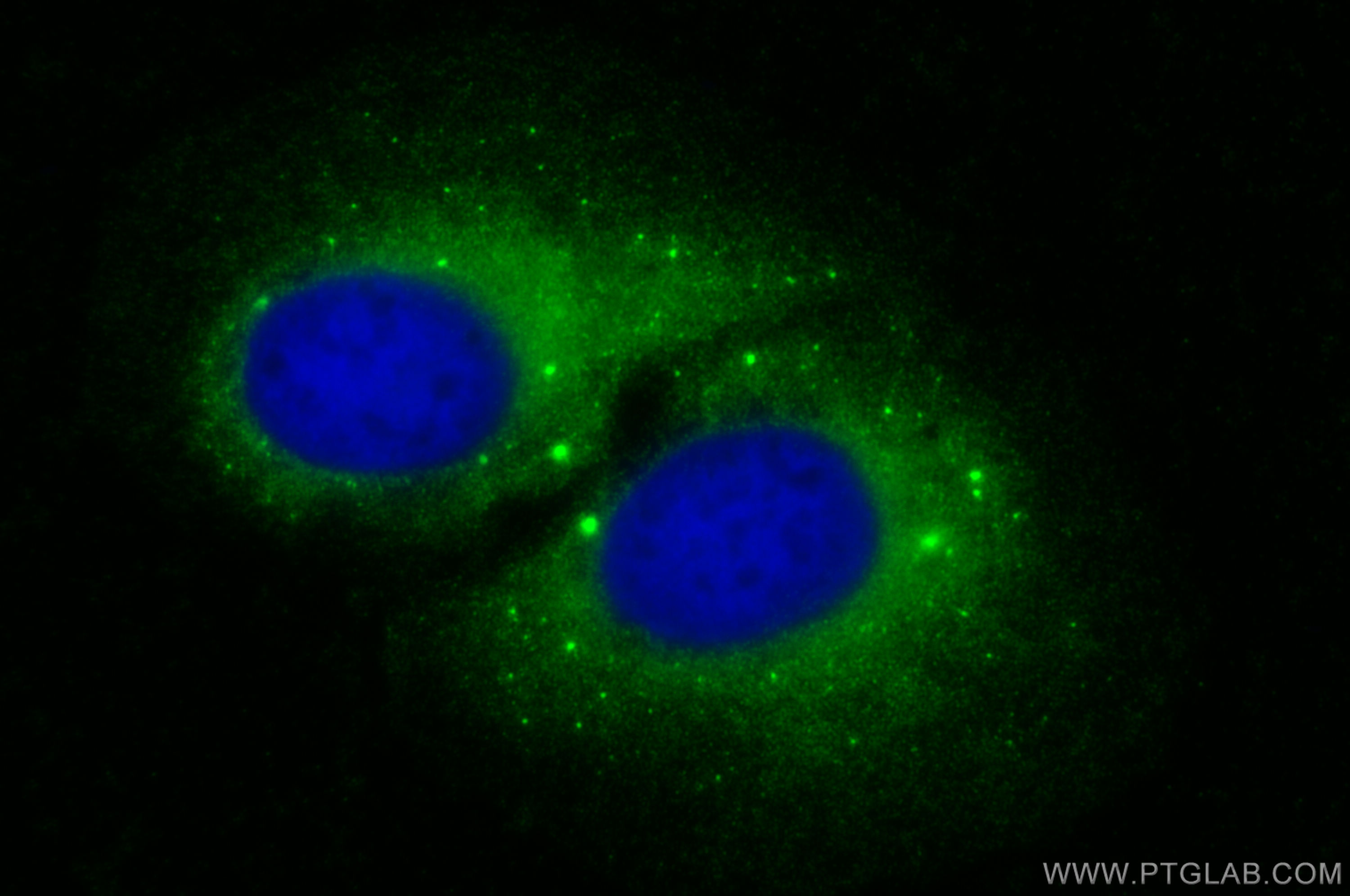 IF Staining of U2OS using 27504-1-AP