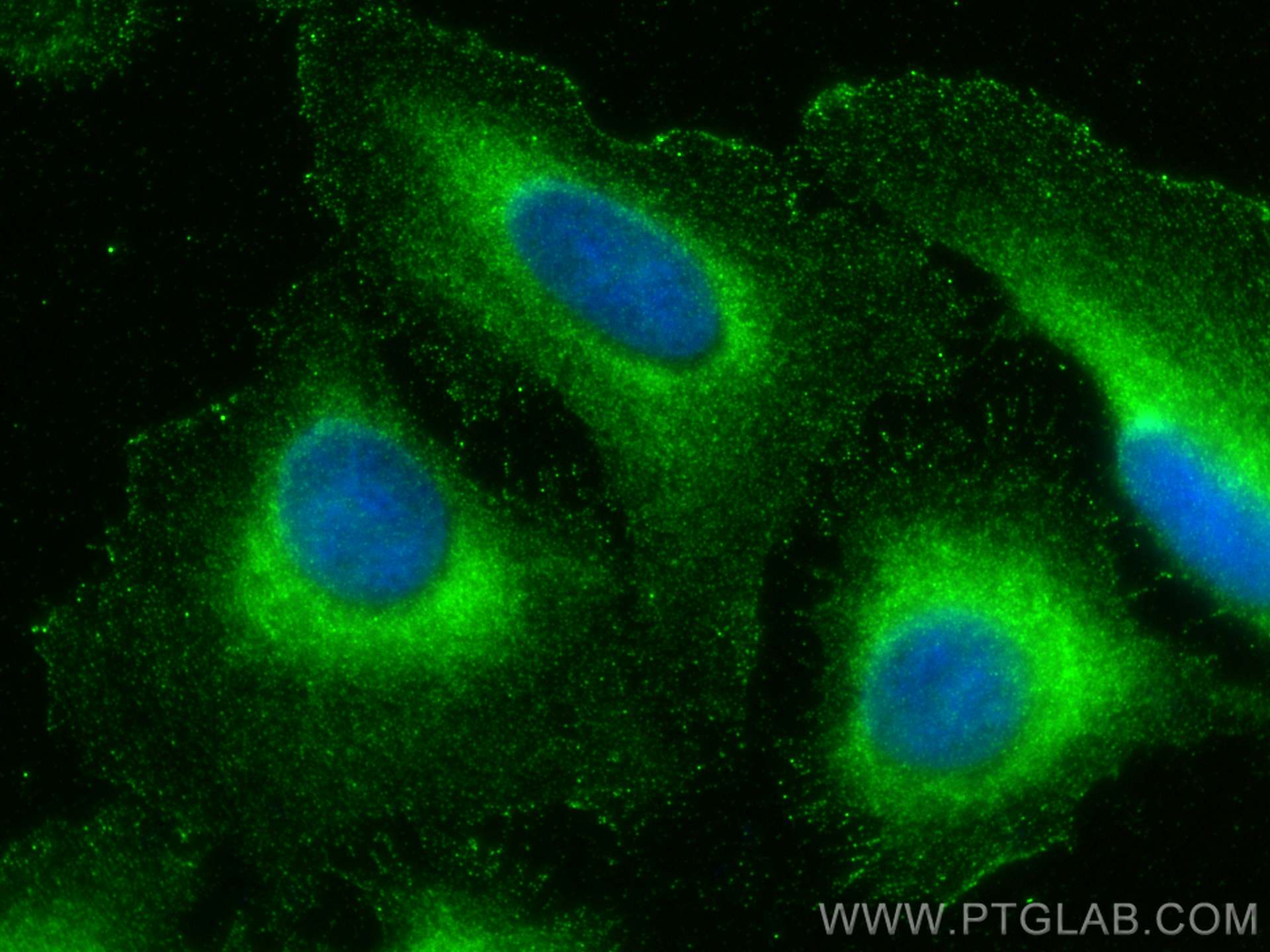 IF Staining of U2OS using 26922-1-AP