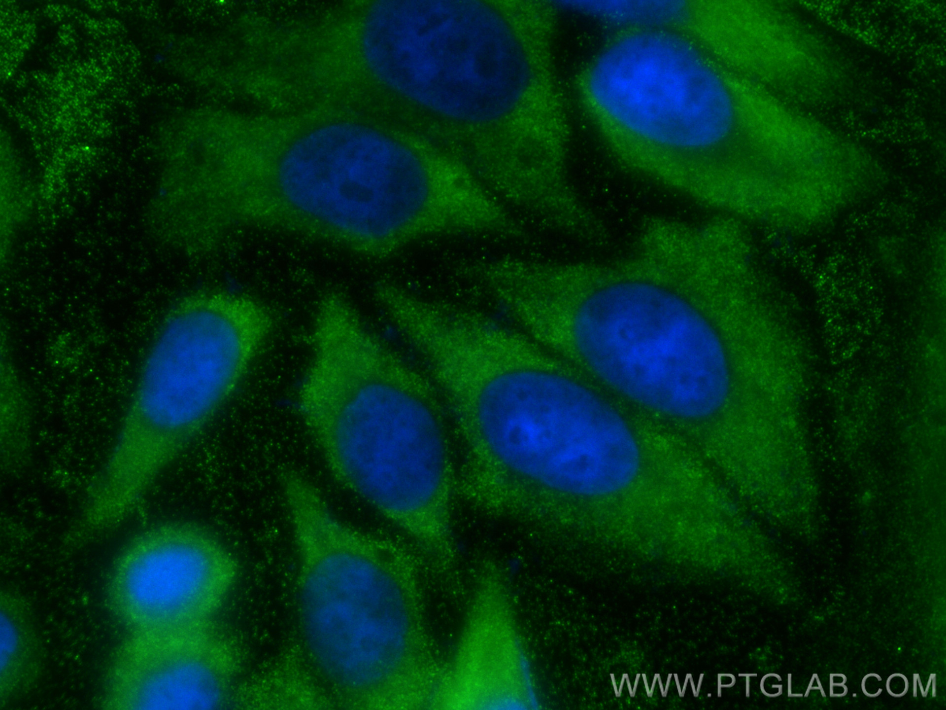 IF Staining of HepG2 using 68500-1-Ig (same clone as 68500-1-PBS)