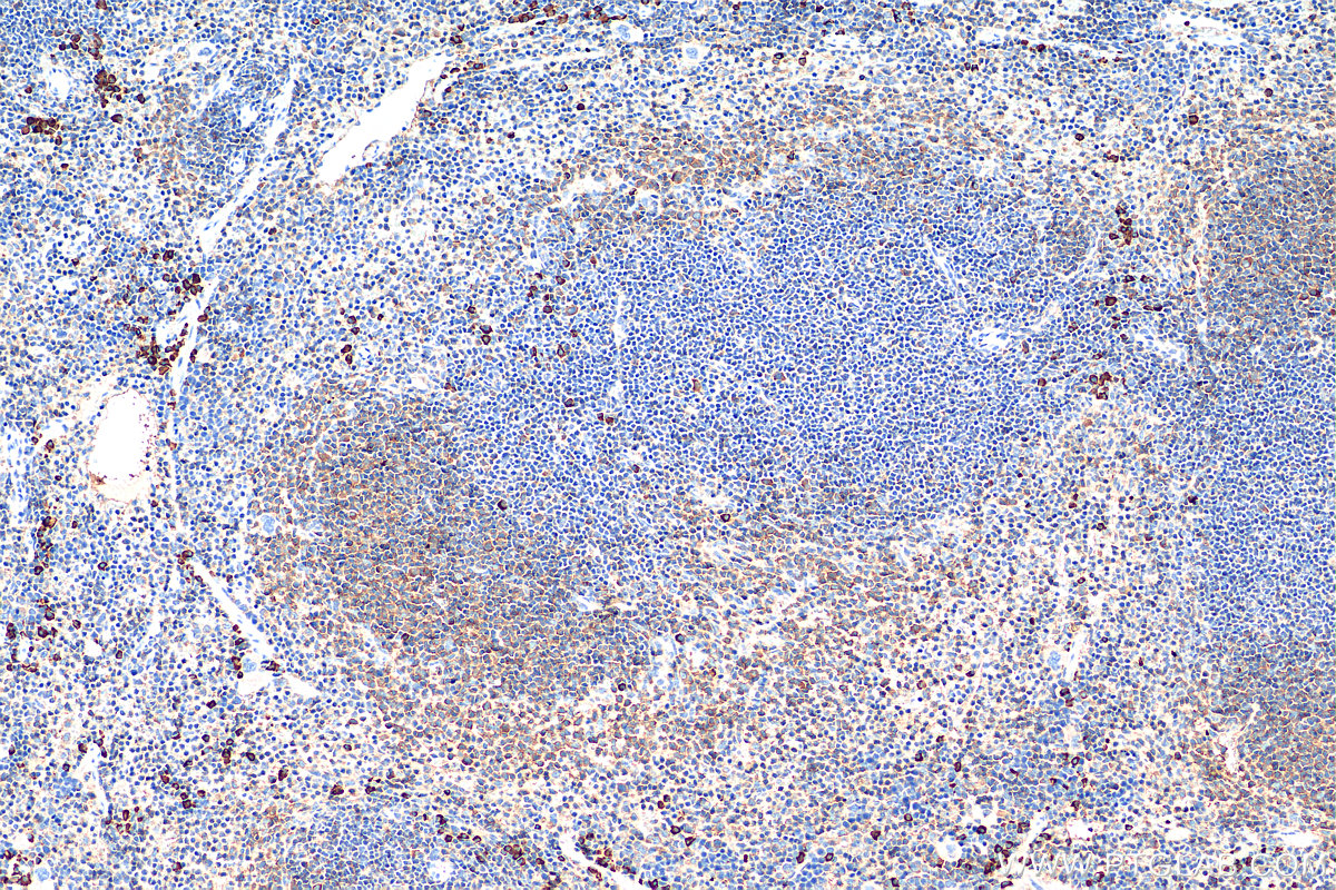 IHC staining of mouse spleen using 68500-1-Ig (same clone as 68500-1-PBS)