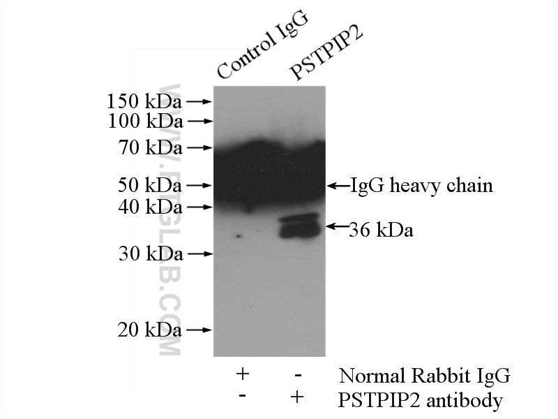 IP experiment of Raji using 13450-1-AP