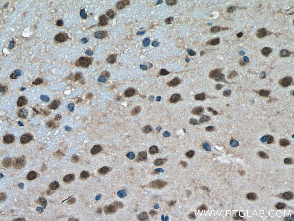 IHC staining of mouse brain using 55186-1-AP