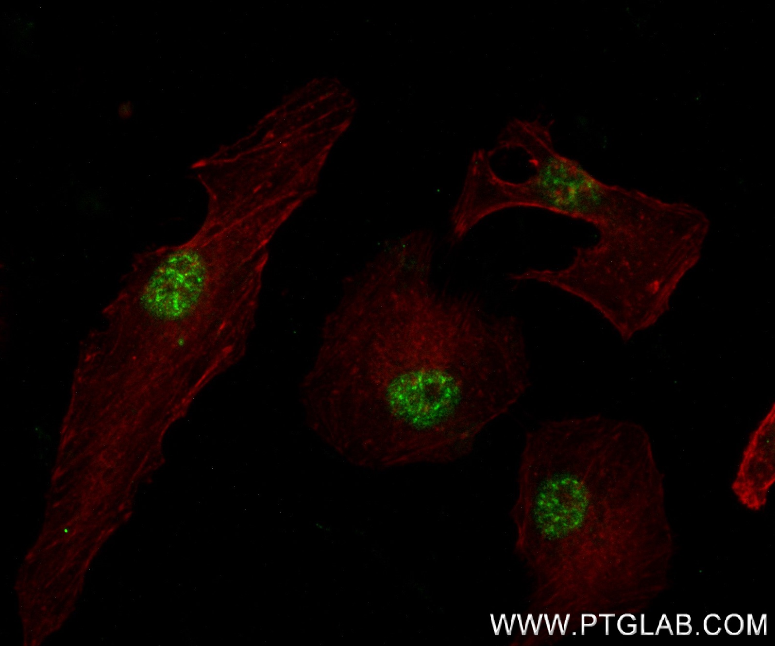 IF Staining of HeLa using 80718-7-RR (same clone as 80718-7-PBS)