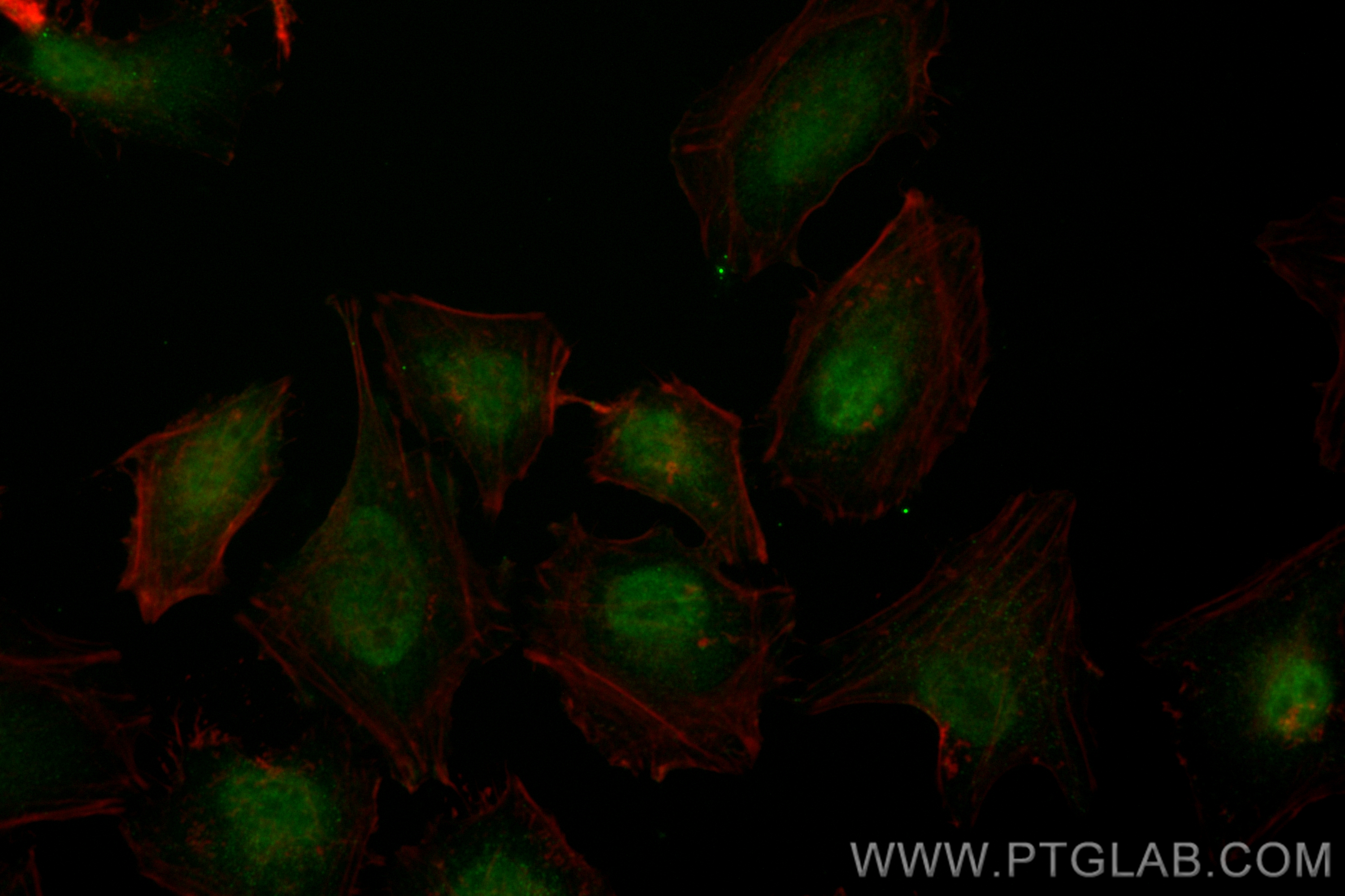 IF Staining of HeLa using CL488-80718-7