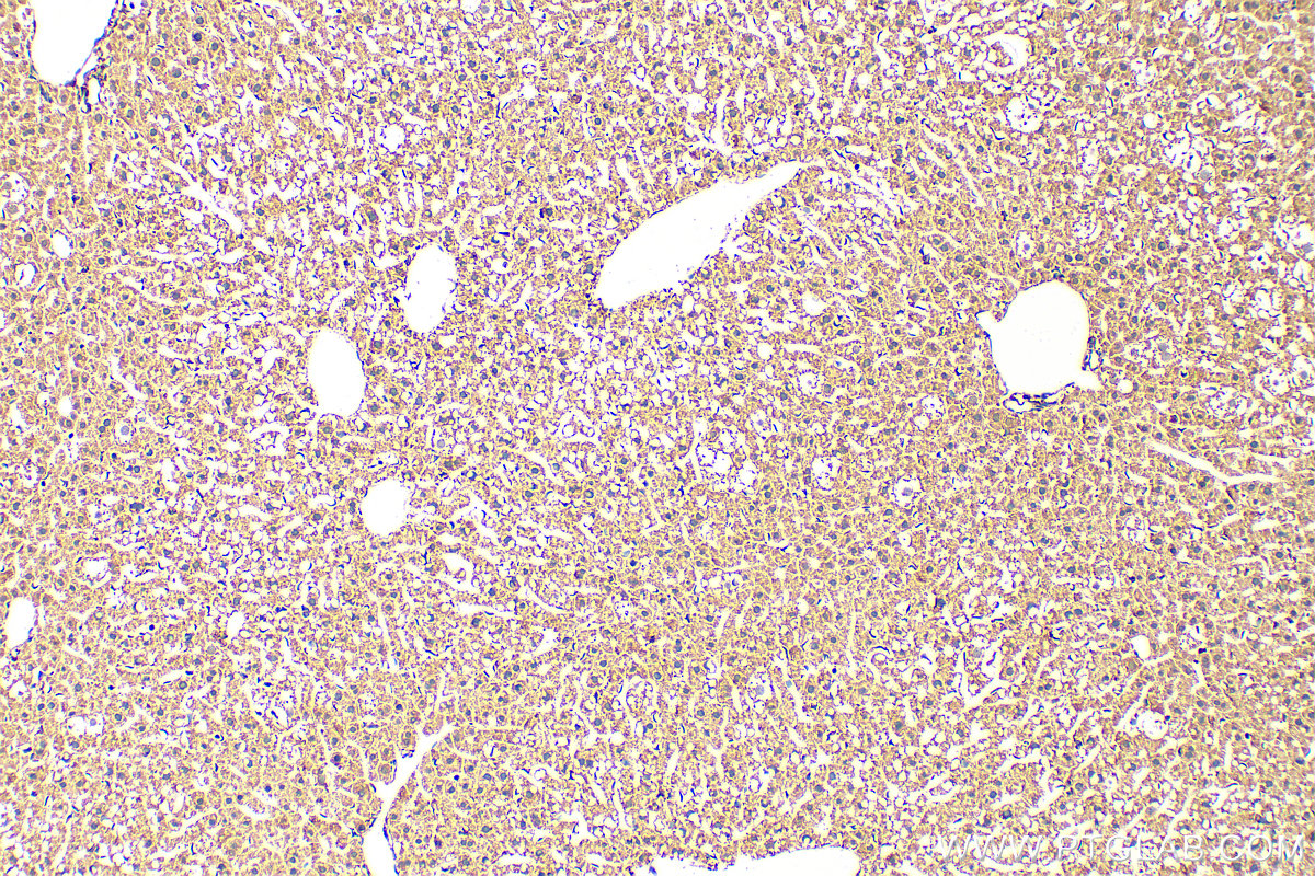 IHC staining of mouse liver using 27061-1-AP