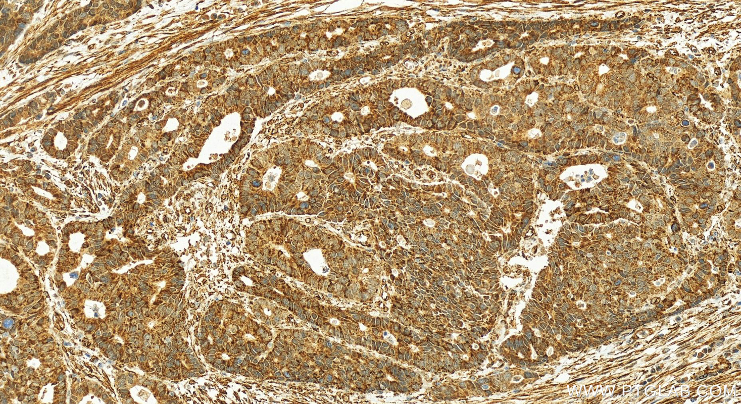 IHC staining of human stomach using 13393-1-AP