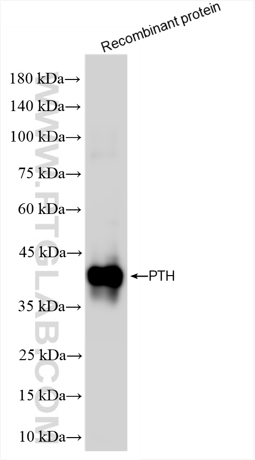 WB analysis of Recombinant protein using 84960-4-RR (same clone as 84960-4-PBS)