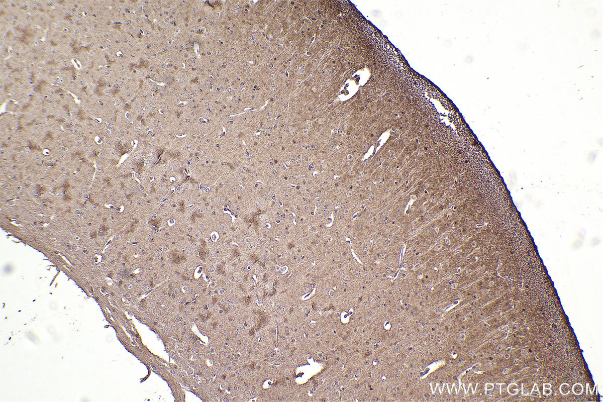 IHC staining of mouse brain using 67141-1-Ig