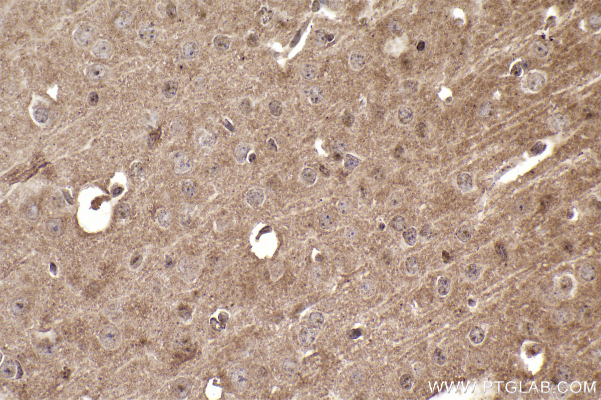 IHC staining of mouse brain using 67141-1-Ig (same clone as 67141-1-PBS)