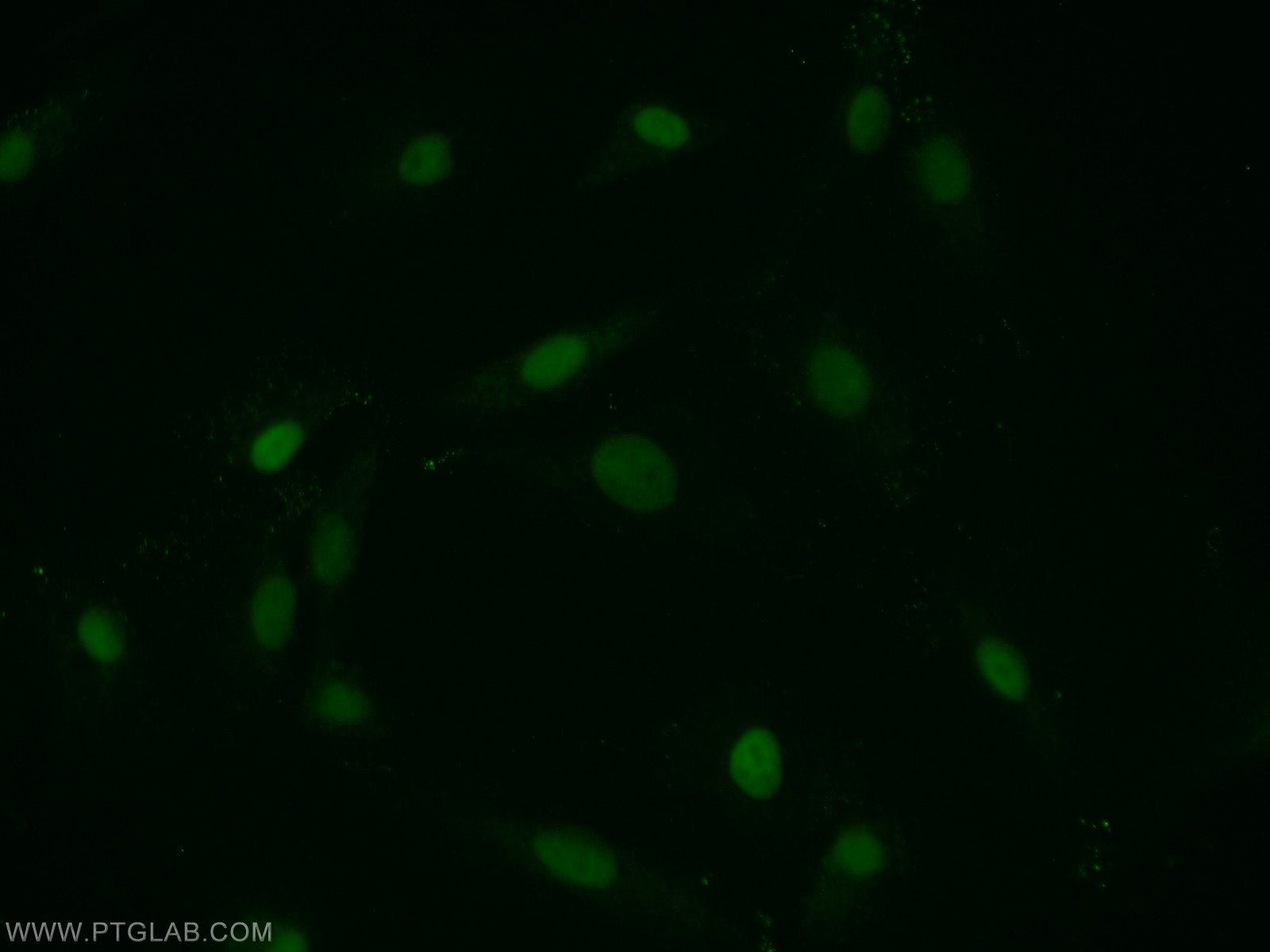 IF Staining of A549 using 12106-1-AP