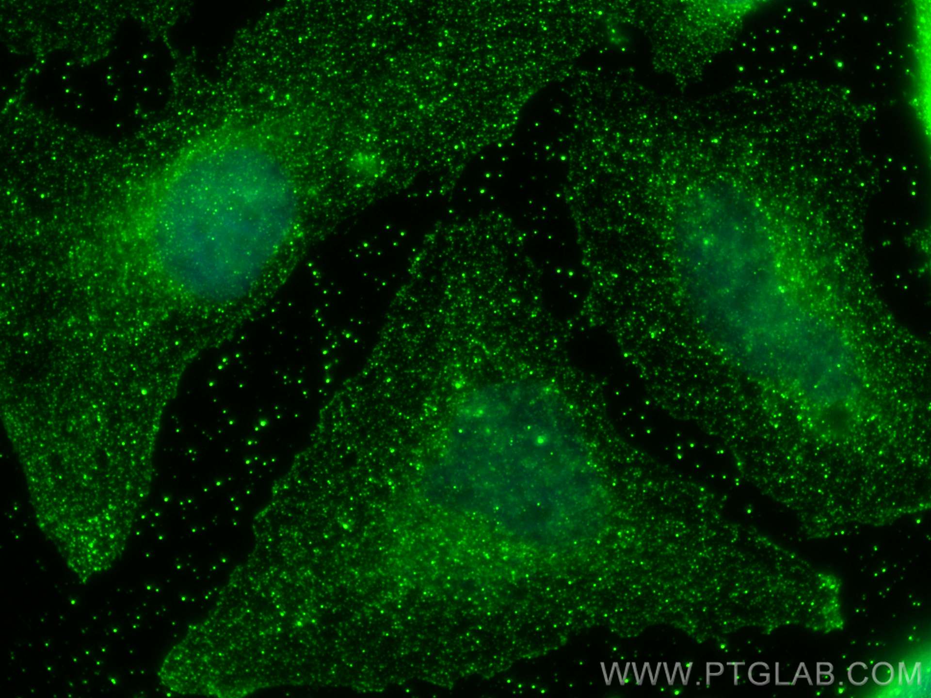 IF Staining of HeLa using 67584-1-Ig