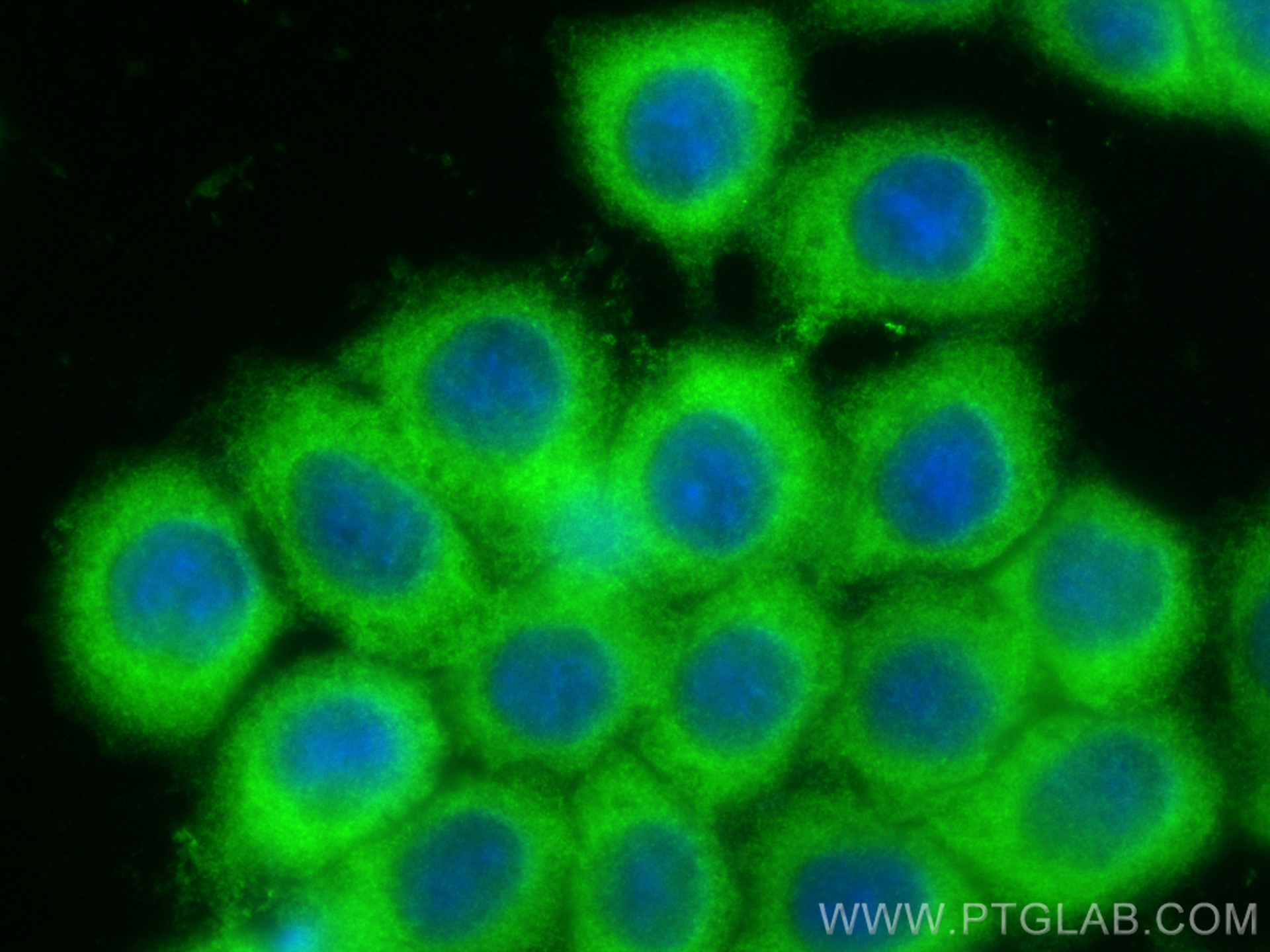 IF Staining of BxPC-3 using 11334-1-AP