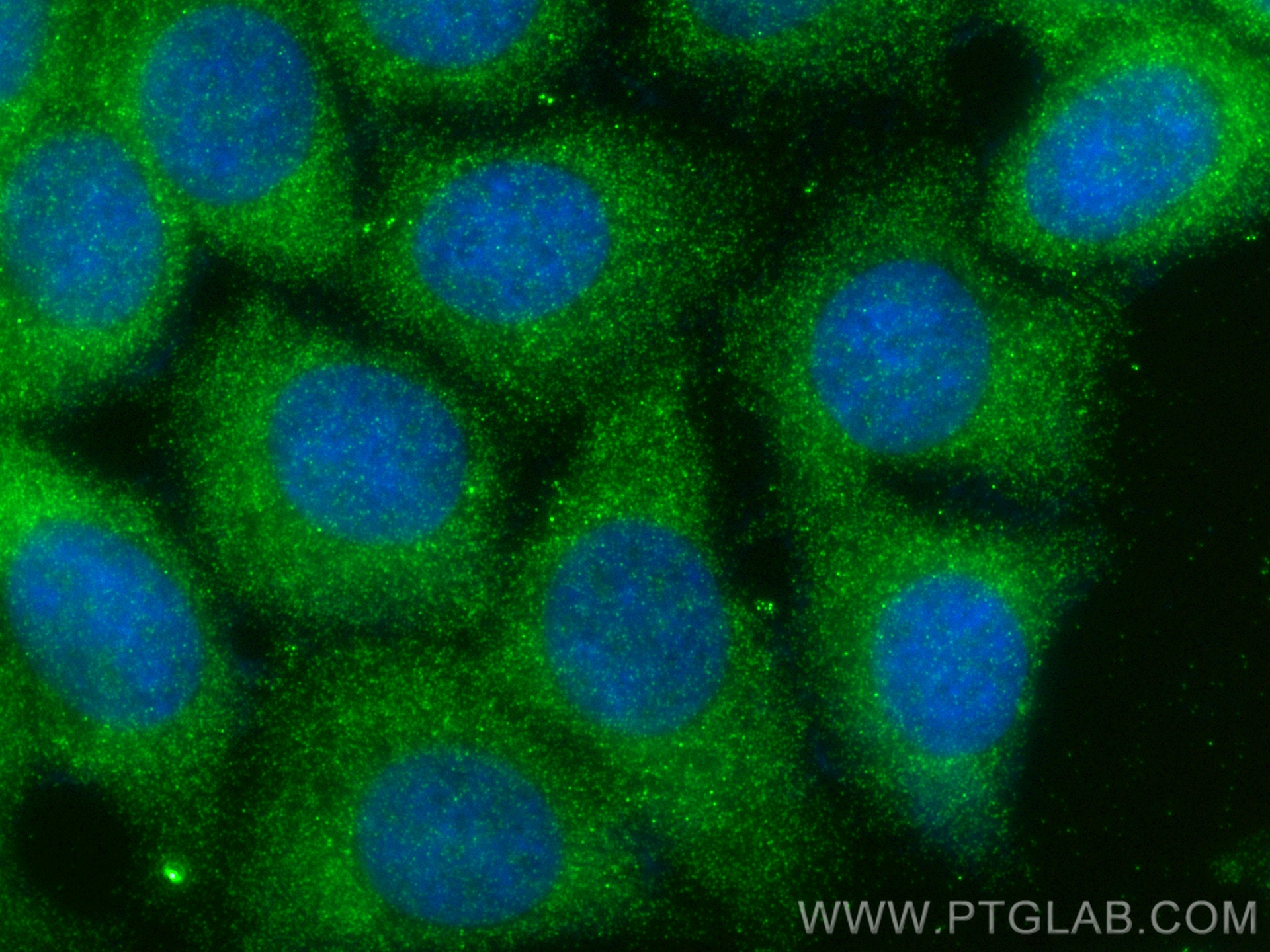 IF Staining of MCF-7 using 24570-1-AP