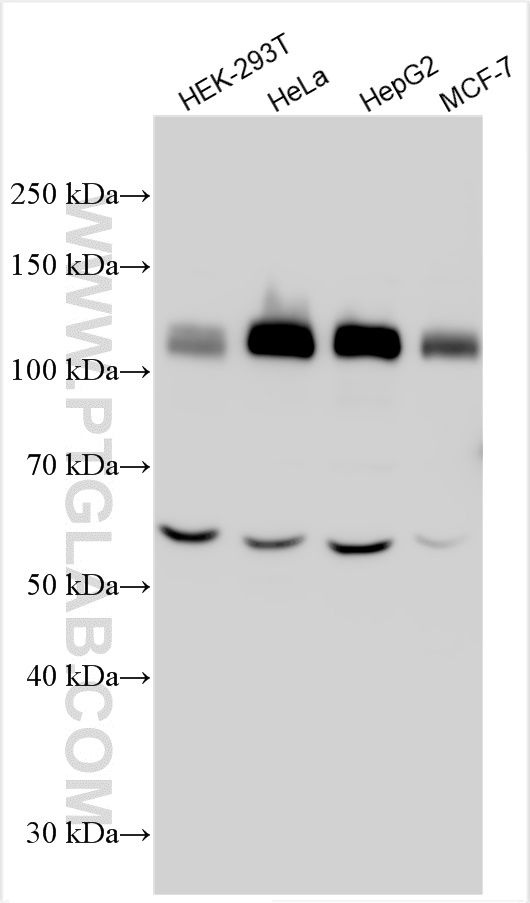 WB analysis using 31215-1-AP