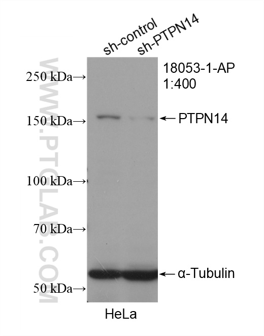 WB analysis of HeLa using 18053-1-AP