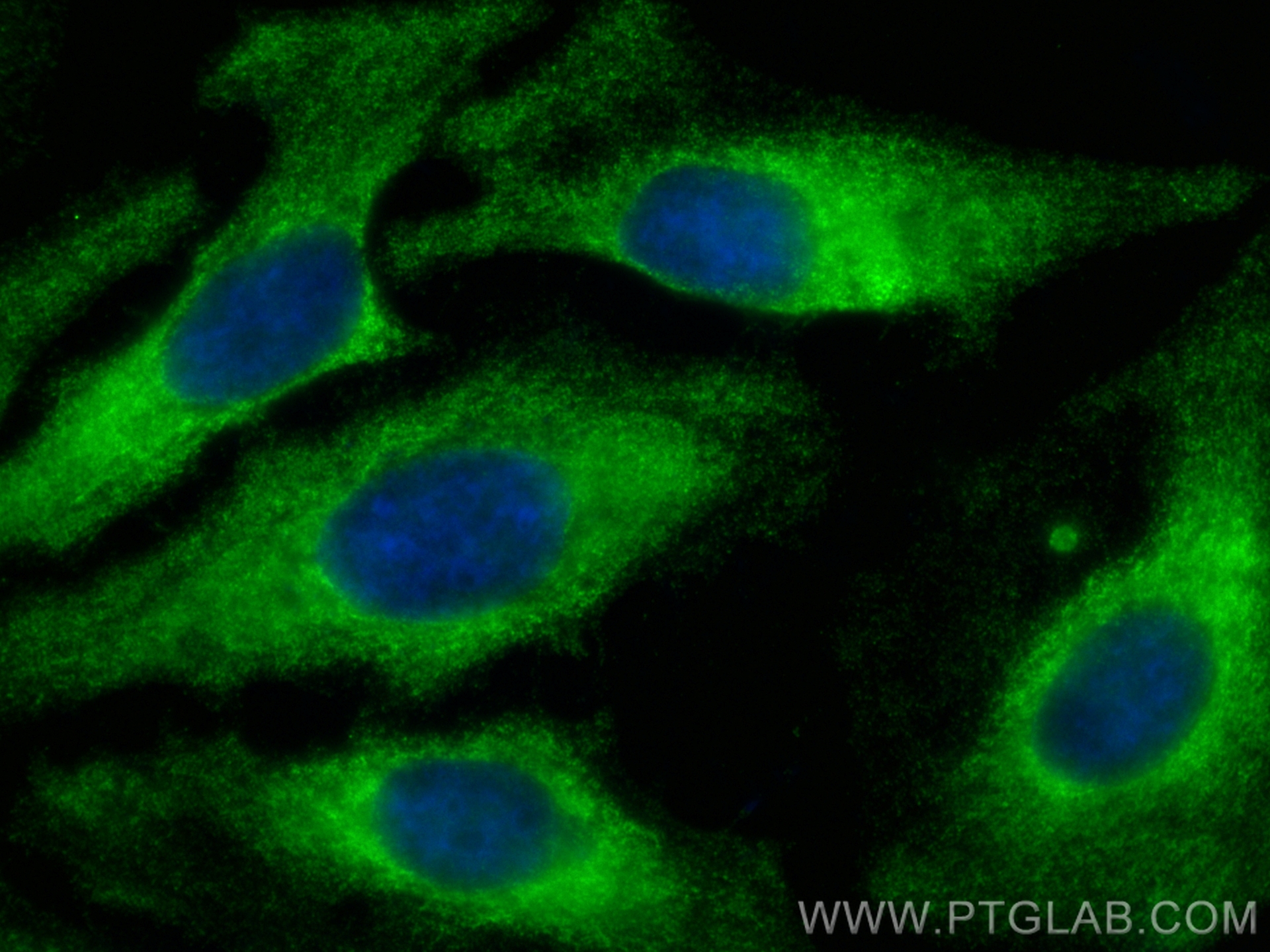 IF Staining of HeLa using 67744-1-Ig