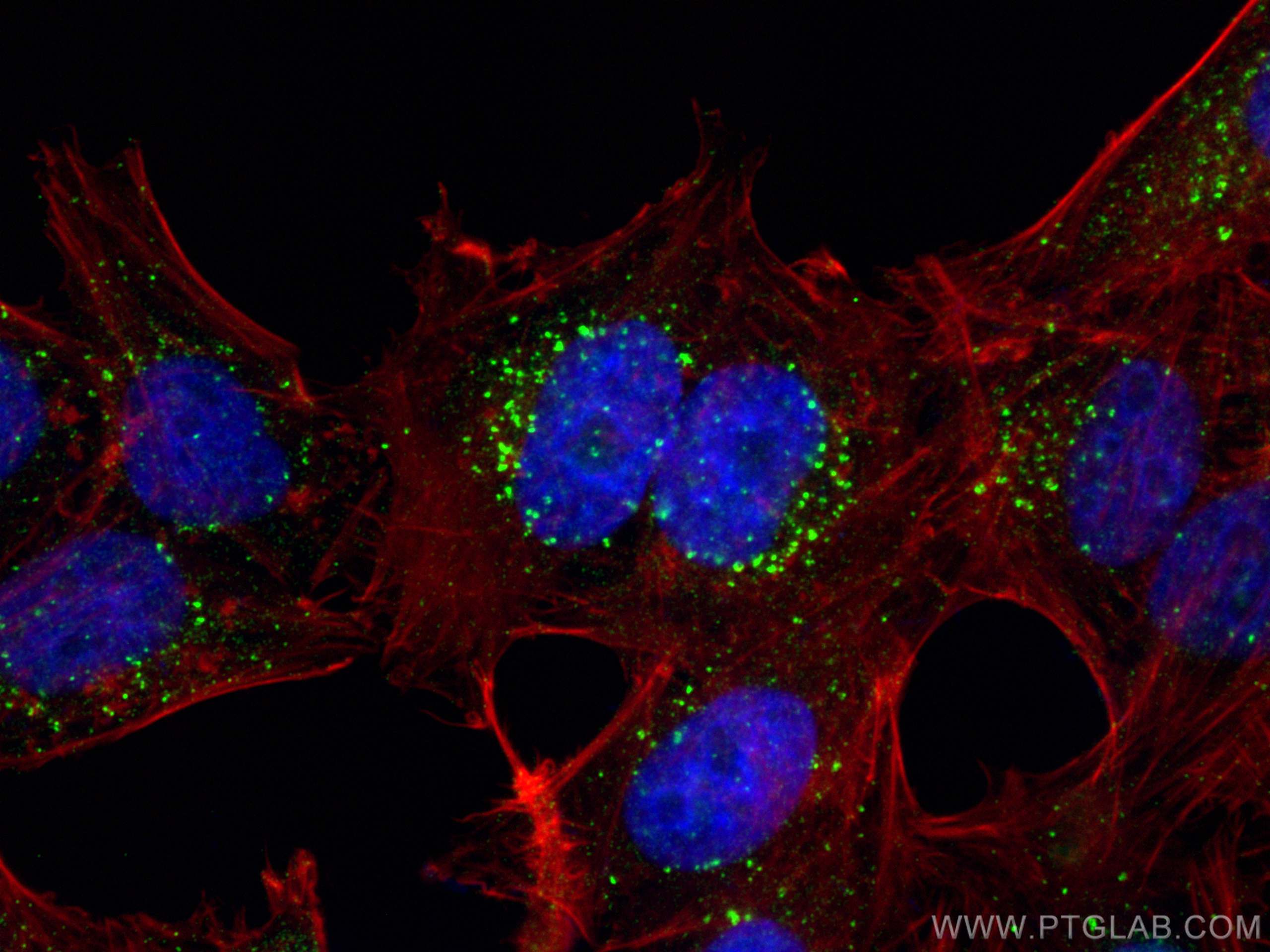 IF Staining of HepG2 using 10472-1-AP