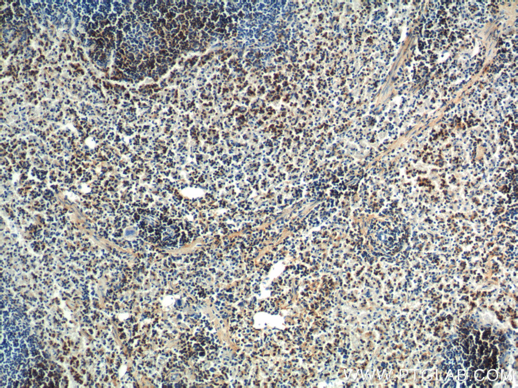 IHC staining of mouse spleen using 14515-1-AP