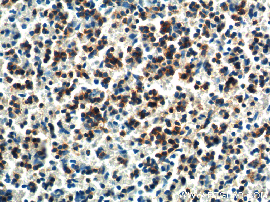 IHC staining of mouse spleen using 14515-1-AP